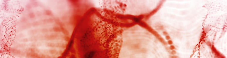 hsCRP - ultrasensitive CRP